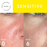Sensitive skin TRIO Set NUORI