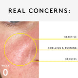 Sensitive skin TRIO Set NUORI
